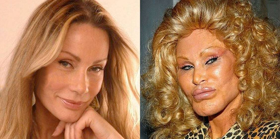 Вредны ли пластические операции?