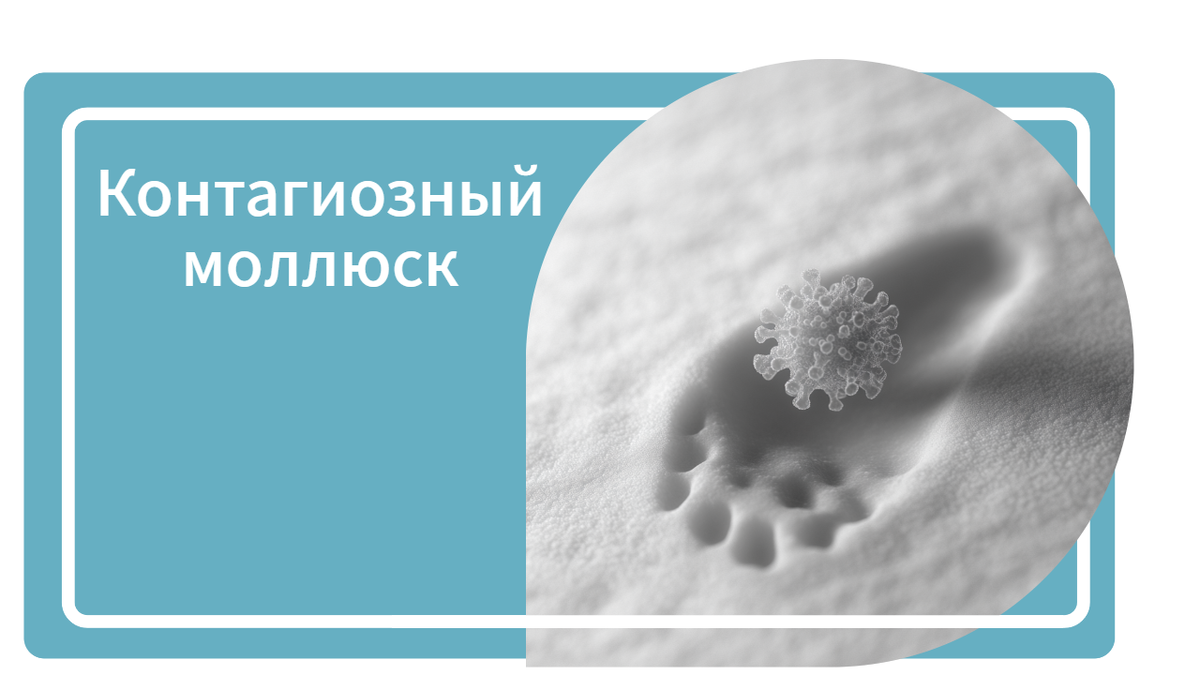 Контагиозный моллюск