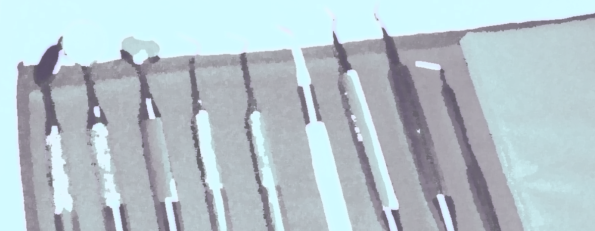    Зубы мудрости: как ускорить заживление и уменьшить боль после удаления? Отвечает эксперт (фото 2)