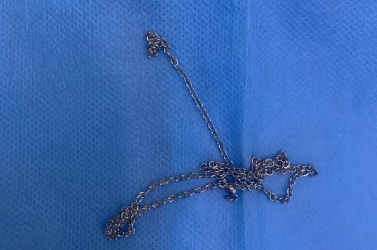    В Туапсе врачи достали из желудка ребенка проглоченную цепочку