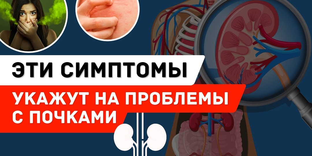 3 симптома, которые могут говорить о проблемах с почками