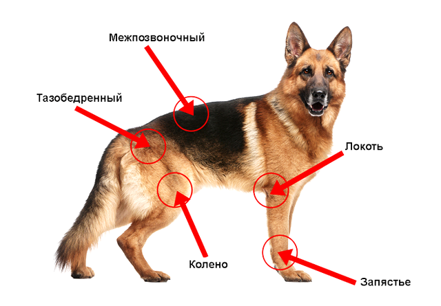 Артрит чаще всего поражает суставы, которые испытывают наибольшую нагрузку