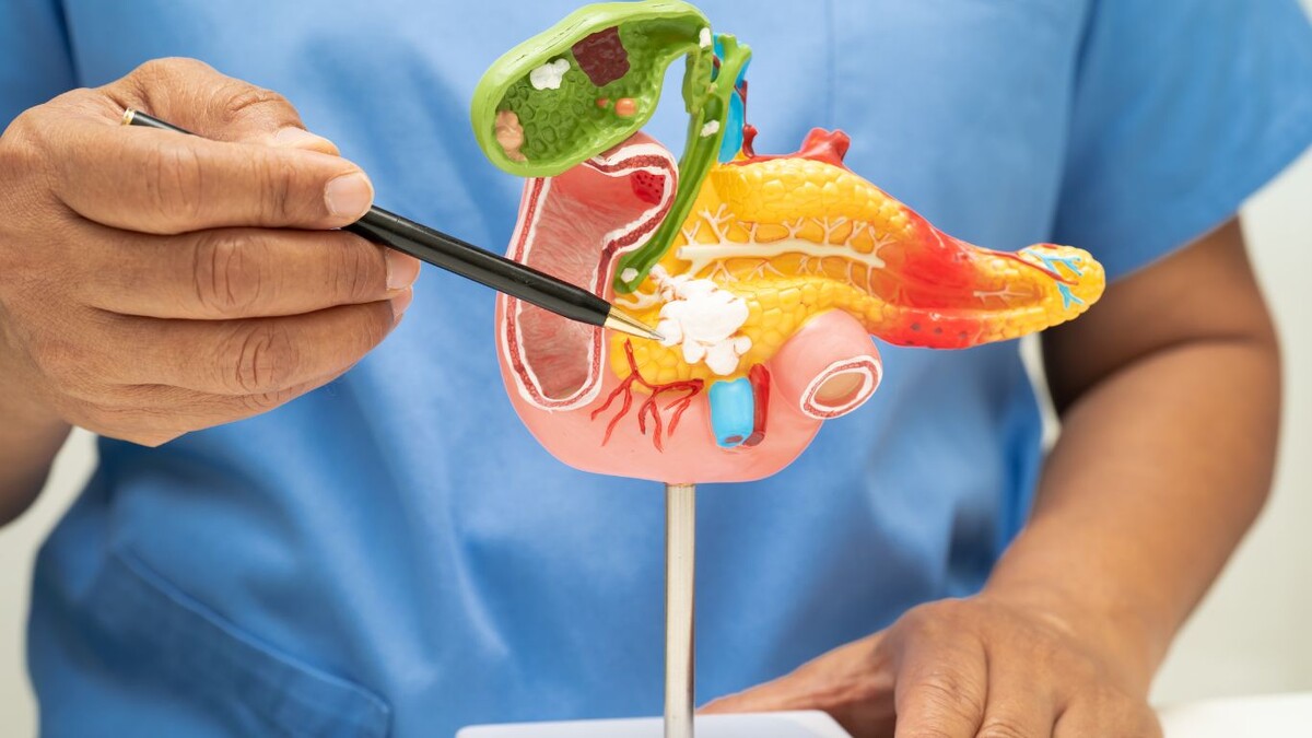 Удалять весь пузырь или только камни? Раскрываем хирургические секреты современной медицины 