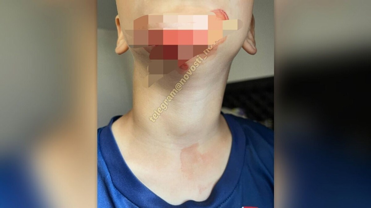    Фото: t.me/novosti_novoross