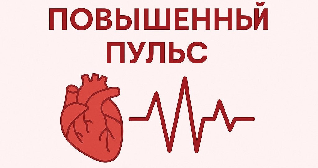 💾Пульс 100 — не «особенность», а звонок