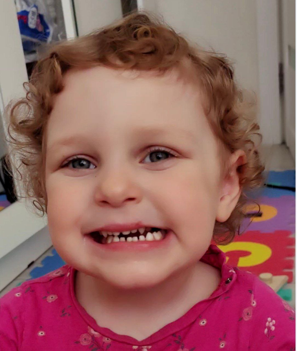 причина по которой мы решили срочно уходить от соски - открытый прикус