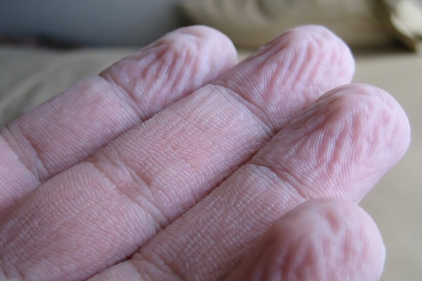     Пальцы сморщиваются одинаково каждый раз, когда вы долго находитесь в воде