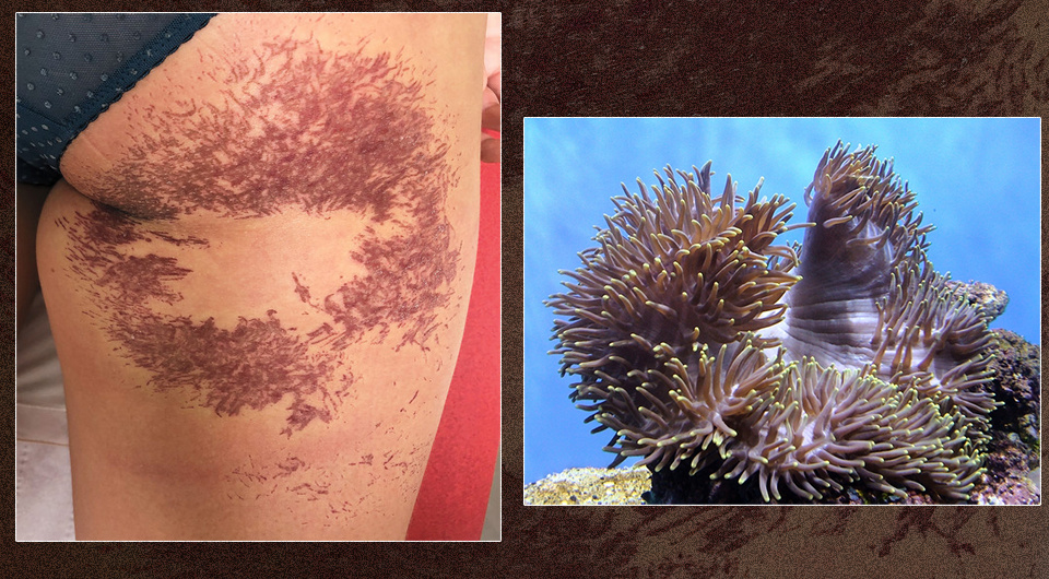   N + 1; Weniko Caré, Raphaële Mestiri / NEJM, 2025; Erik Wilde / Flickr / CC BY-SA 2.0