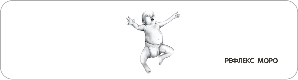 Рефлекс Моро