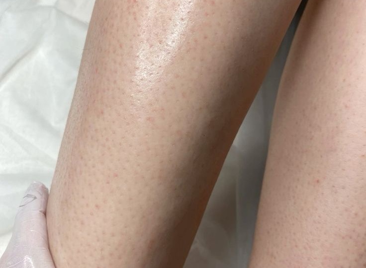 Гладкая кожа + Идеальные брови: Как этот бьюти-дуэт меняет все и почему стоит довериться профессионалу