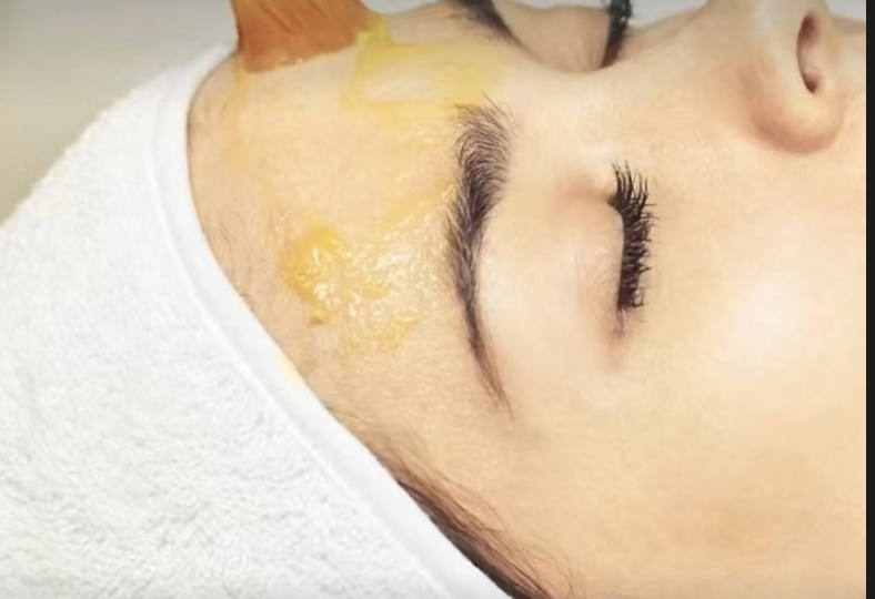 🌼 ЖЕЛТЫЙ (РЕТИНОЕВЫЙ) ПИЛИНГ: ОМОЛОЖЕНИЕ, БОРЬБА С АКНЕ И ПИГМЕНТАЦИЕЙ. ВСЁ, ЧТО НУЖНО ЗНАТЬ О ПРОЦЕДУРЕ.🌼