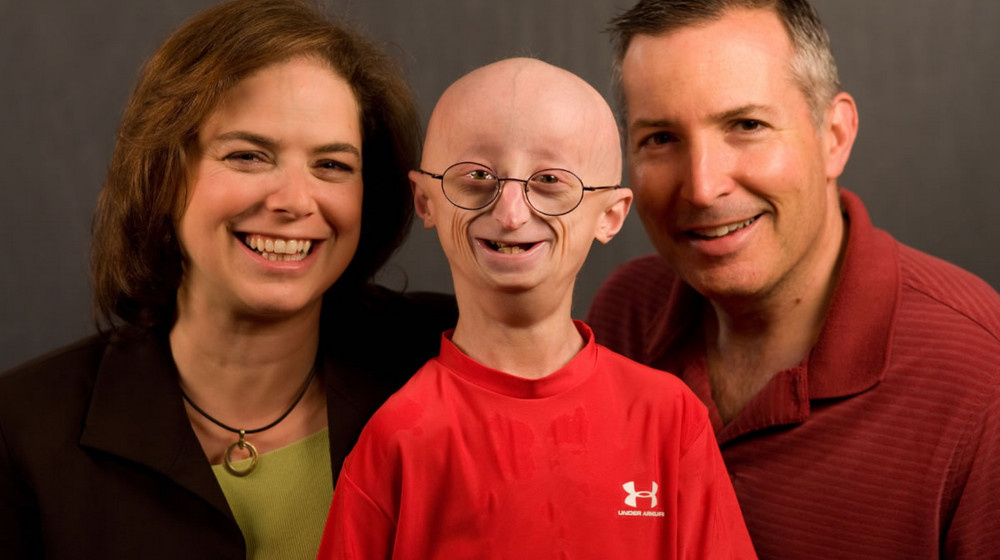    Дети, которые стареют за год как за десятилетие Болезнь Хатчинсона и прорывы генной терапии в 2025