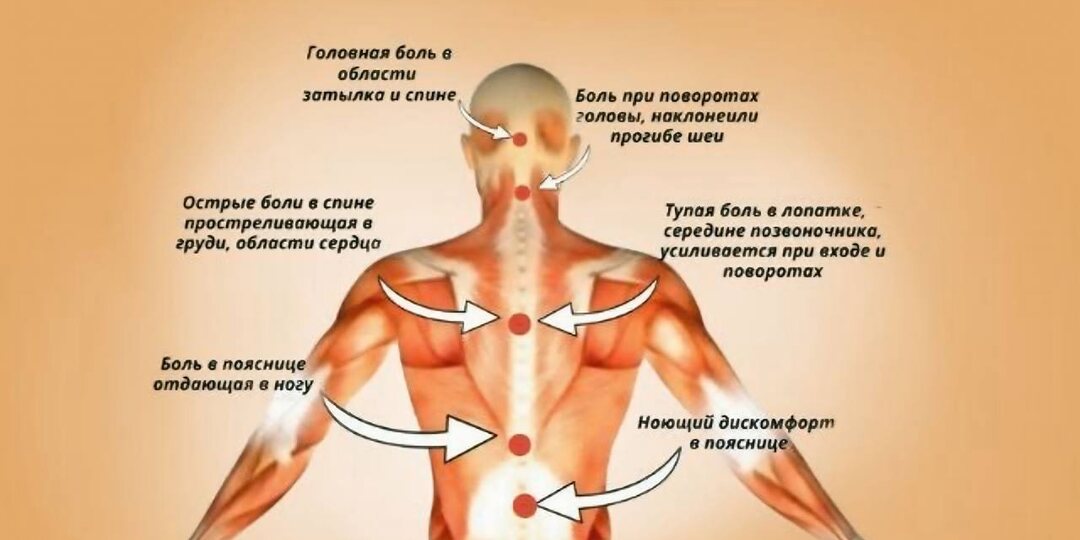 Карта боли на спине: что означает боль в разных её частях — от мышечного напряжения до серьёзных проблем