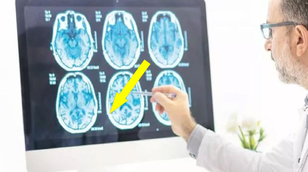    Твоя рука предатель почему она живёт без твоего разрешения