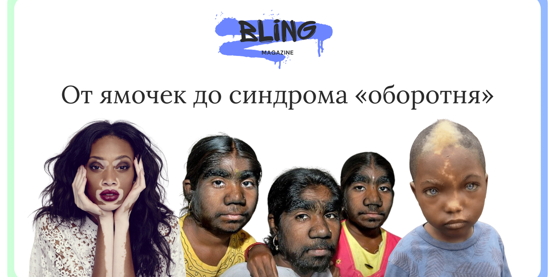 Странные генетические особенности человека