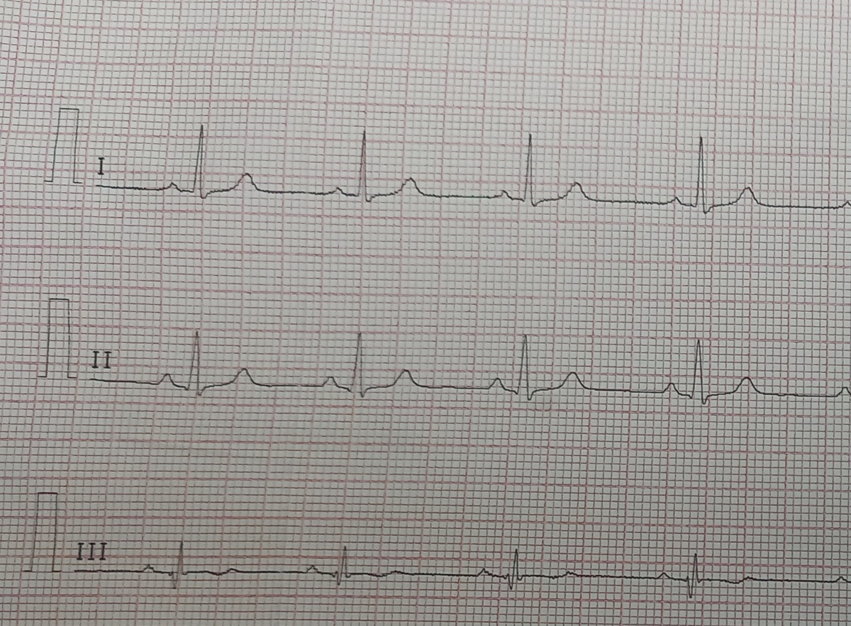 Я стала иногда просить у пациентов разрешения сфотографировать их кардиограмму или дневник давления, чтобы оставалась какая-то радость. Это приятная пленка приятного пациента.