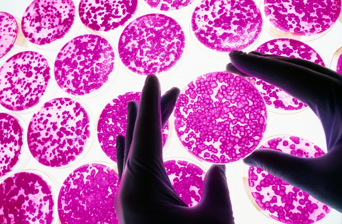 Стволовые клетки (как те, что изображены выше и растут в чашках Петри) способны дифференцироваться в клетки любого типа в организме, в том числе в клетки, которые генерируют и восстанавливают ткани, повреждённые болезнью.Фотография Массимо Брега, Научная фототека