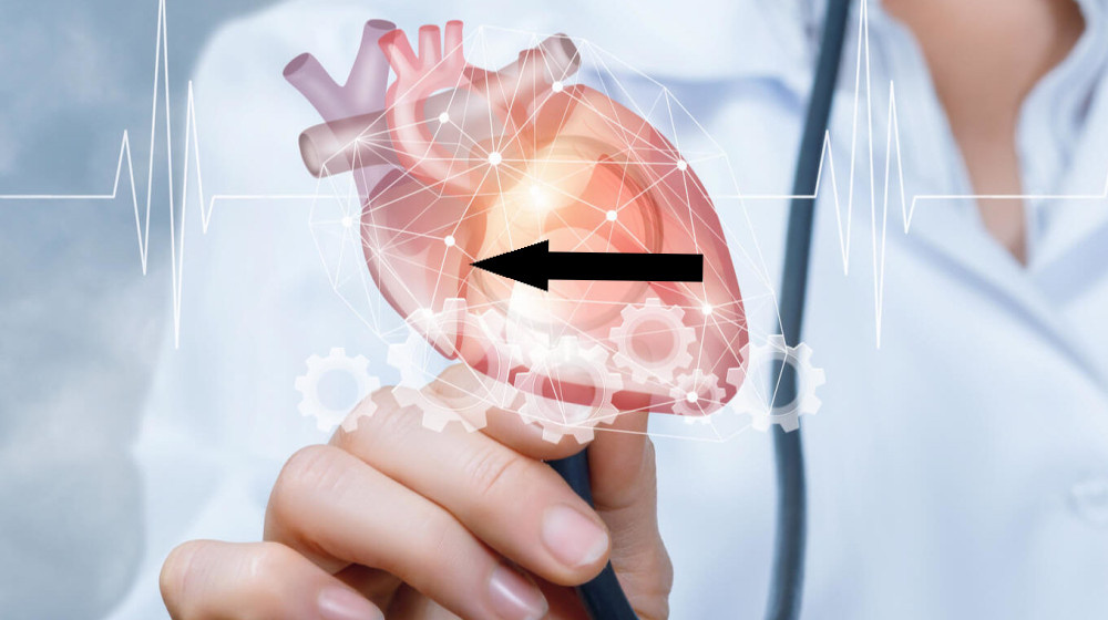    Катехоламиновая буря Как адреналин превращает сердце в бомбу замедленного действия