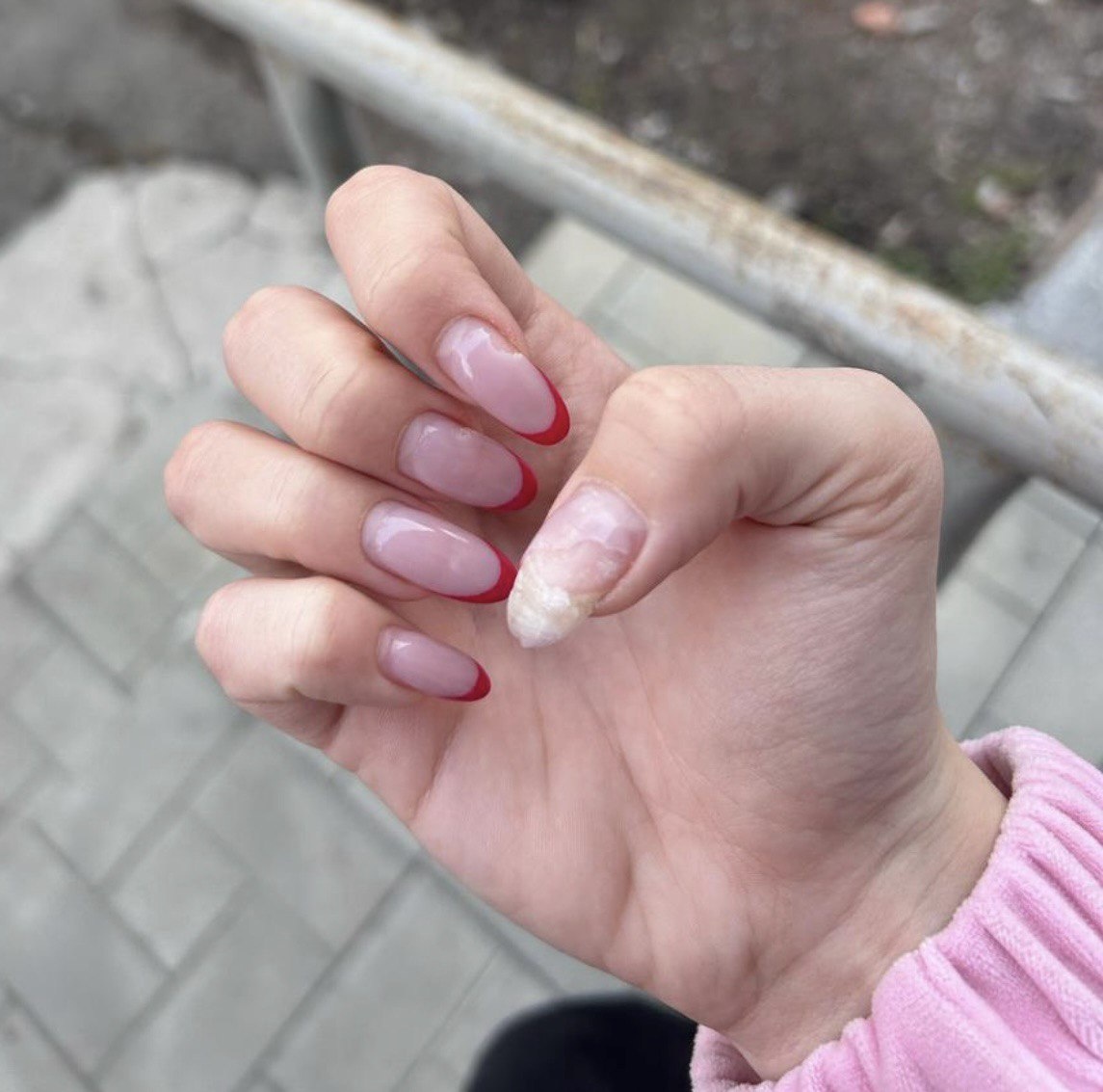 Сильные отслойки