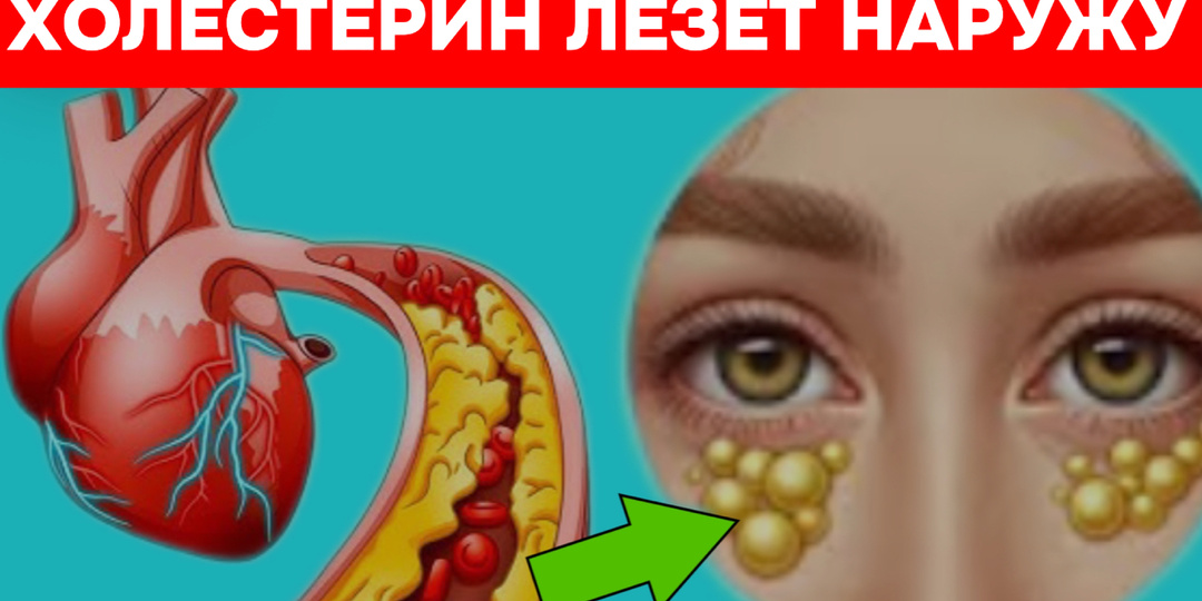 Холестерин после 55: 7 сигналов, которые говорят, что пора действовать