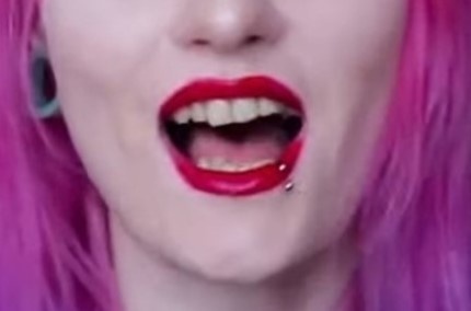 Мои зубы до 