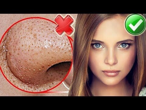 Как избавиться от черных точек
