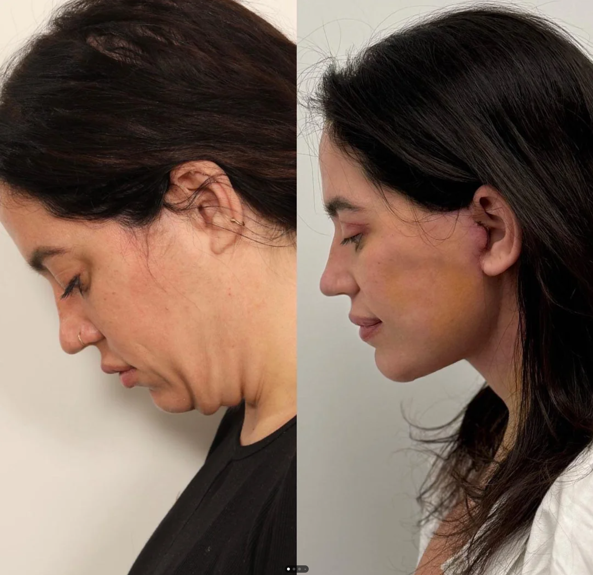 Тогда я ещё не знала, что всего через пару месяцев я увижу в зеркале себя — ДРУГУЮ.
 