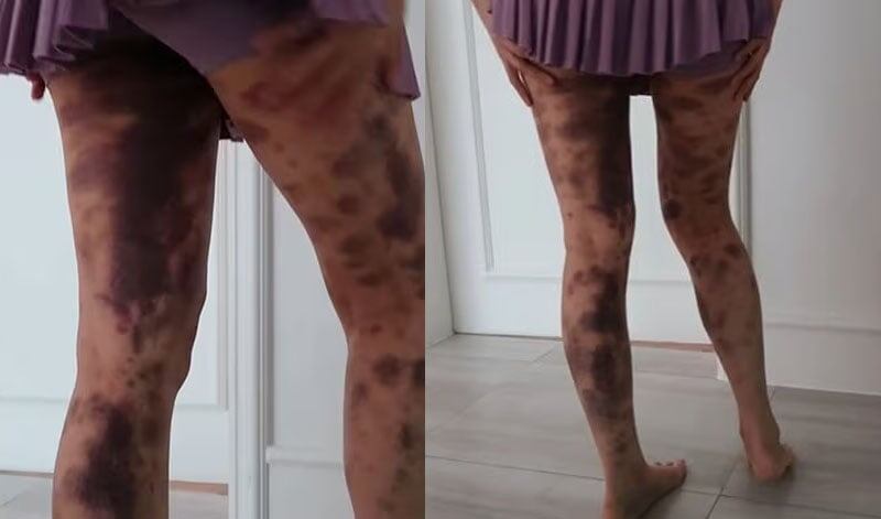 Листайте вправо, чтобы увидеть больше изображений