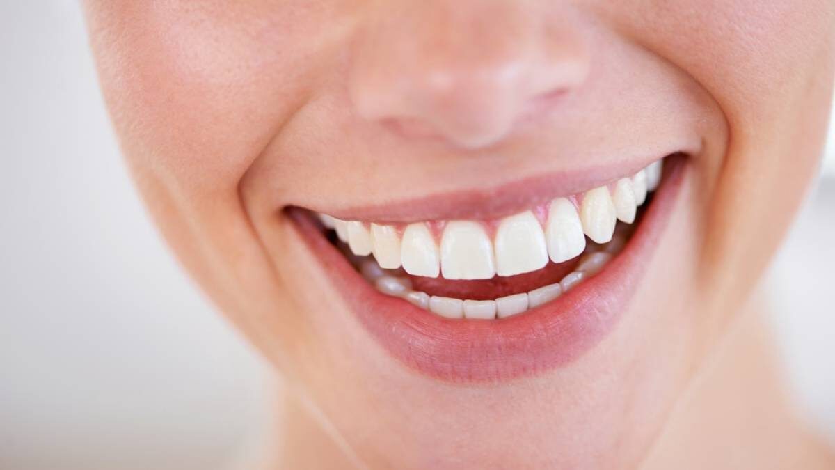    Сегодня «голливудская улыбка» может обойтись пациентам в целое состояние / Фото: Shutterstock