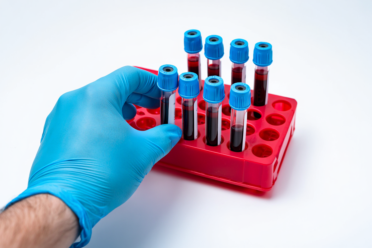 Анализы крови
