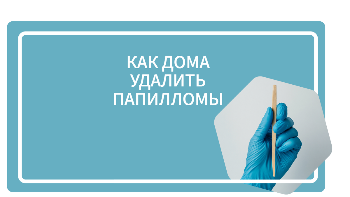 Как дома удалить папилломы