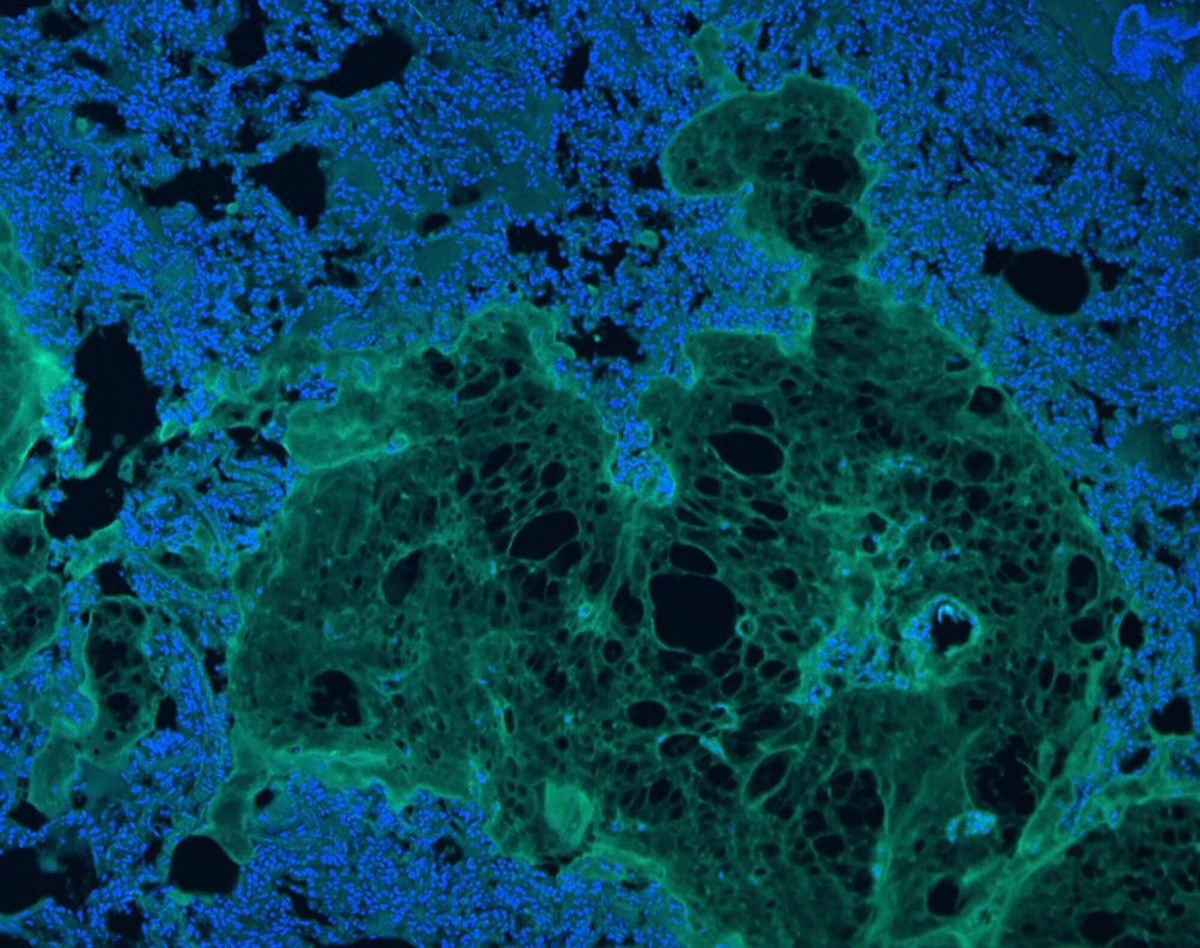    Иммунофлуоресцентное окрашивание макрофагов (зеленый) и ядер (синий) на границе гидрогеля и ткани через семь дней после надрезов артерий у крыс.