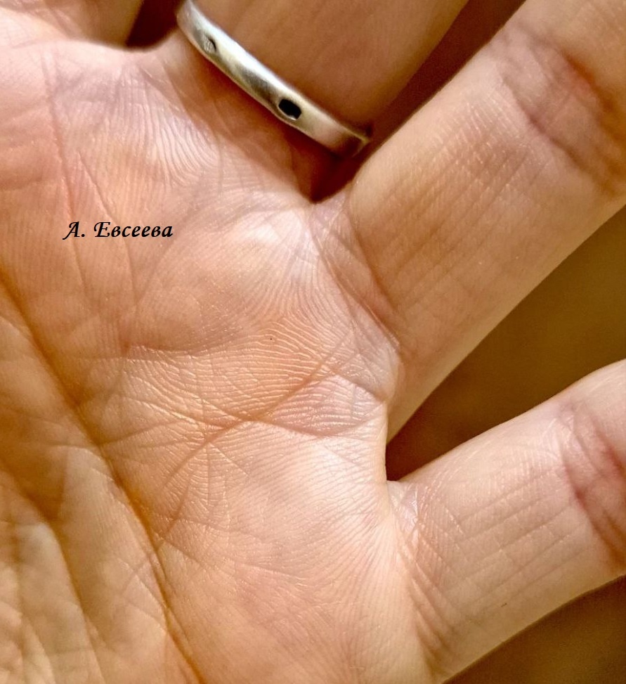 Посмотрите, какая филигранно выточенная рыбка. Прямо Золотая, с головкой и перышками. Это именно тот случай, когда Линия Солнца является составно линияе в знаке. Отличный знак! 