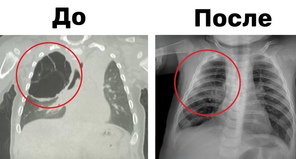    Пресс-служба Министерства здравоохранения Московской области