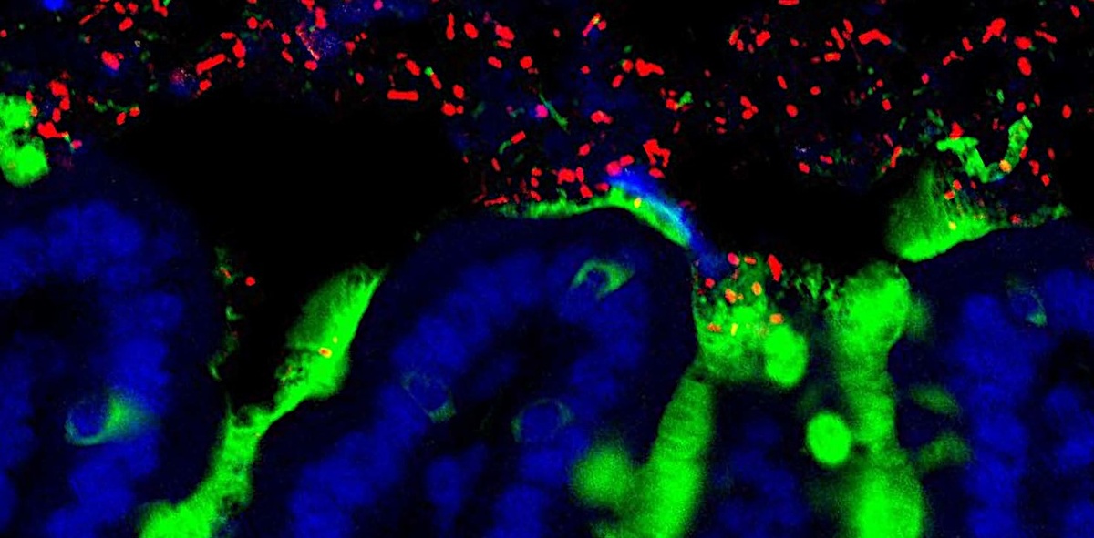 Симбиотические бактерии (красного цвета) в просвете тонкого кишечника. Синим цветом окрашены эпителиальные клетки, зеленым – слизь. © CC BY-NC-SA 2.0/The University of Chicago