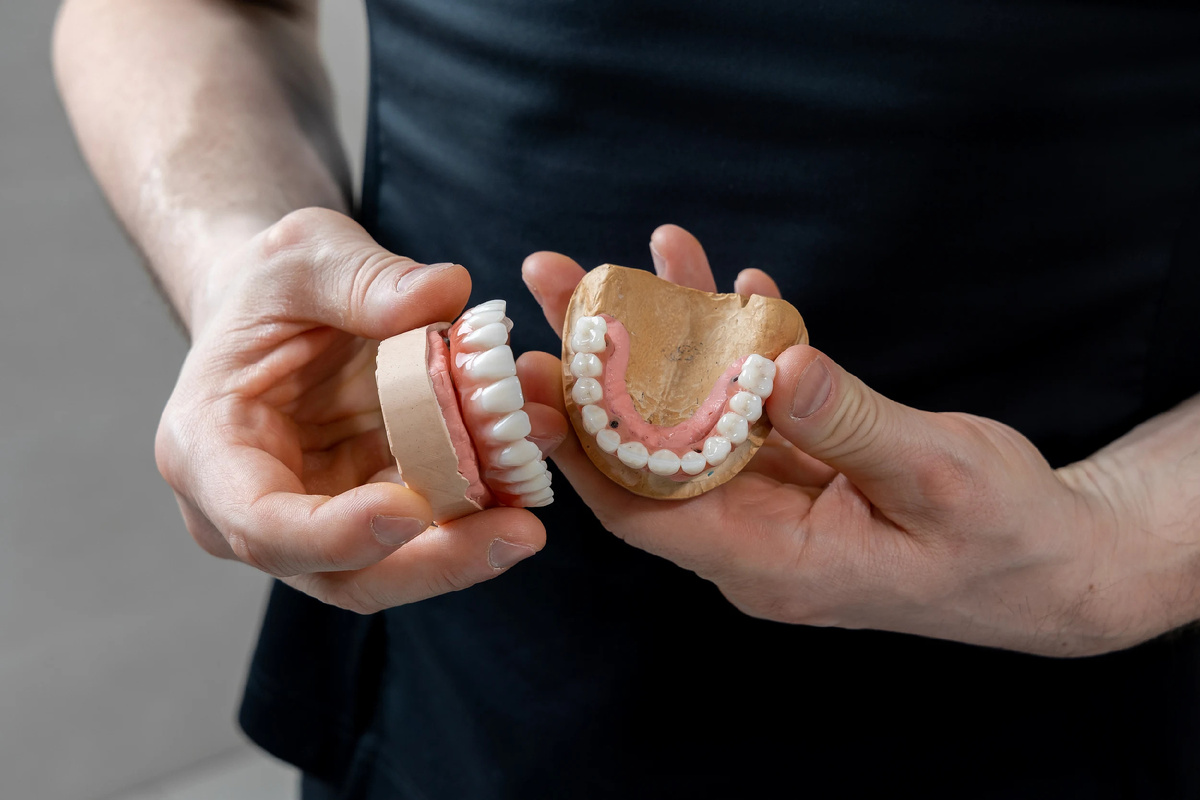 Условно-съемный протез All-on-4