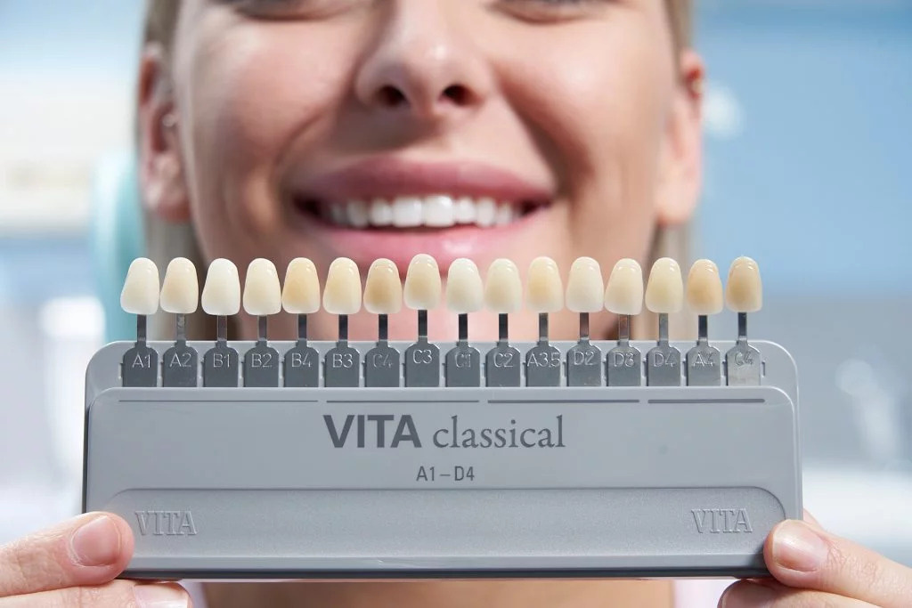 Специальная шкала оттенков Vita