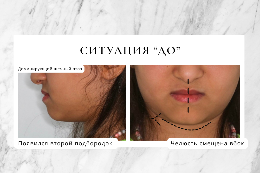 Маленькая пациентка не любила улыбаться, ей не нравилось ее лицо...