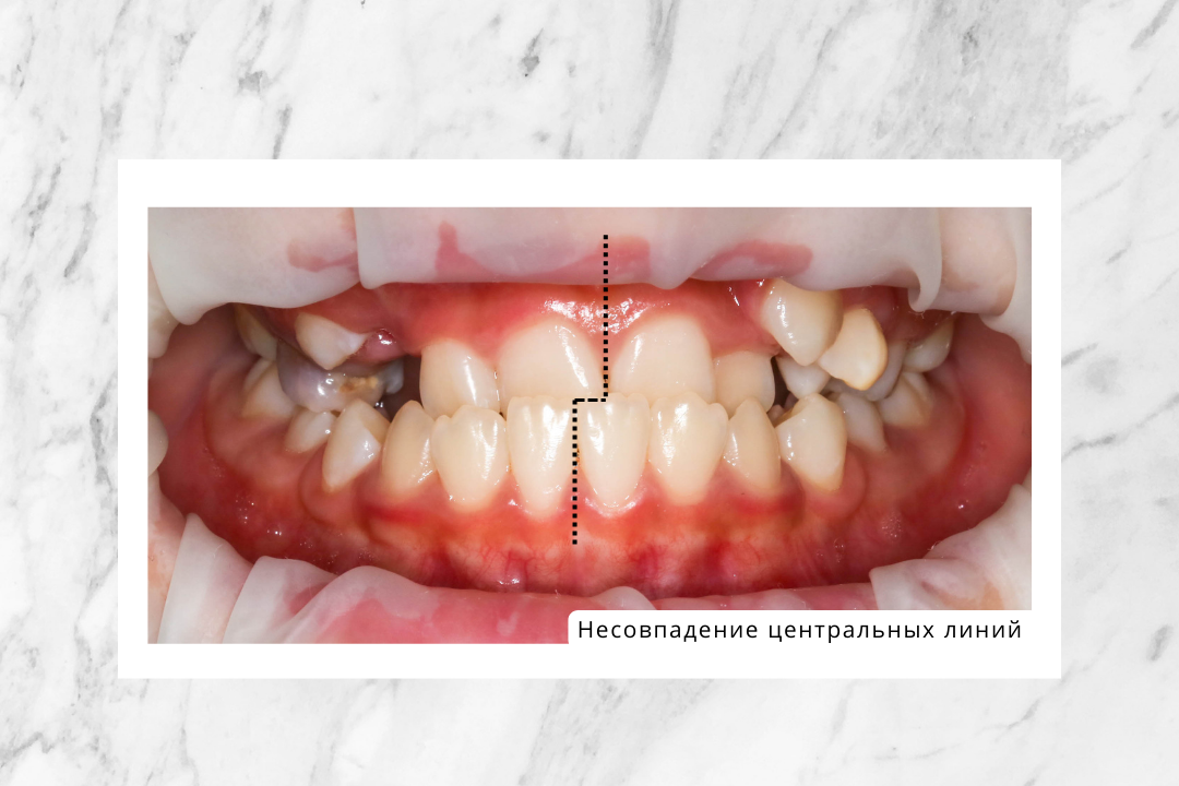 У девочки для ее возраста было уже достаточно серьезных проблем, которые необходимо было оперативно решать