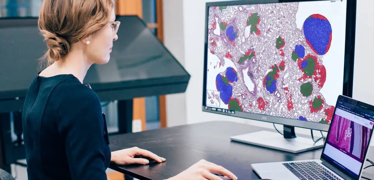 *Aiforia & PathAI & Paige*