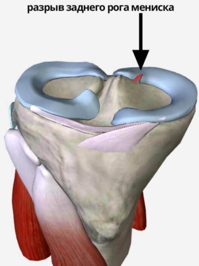 Даже на картинку смотреть больно
