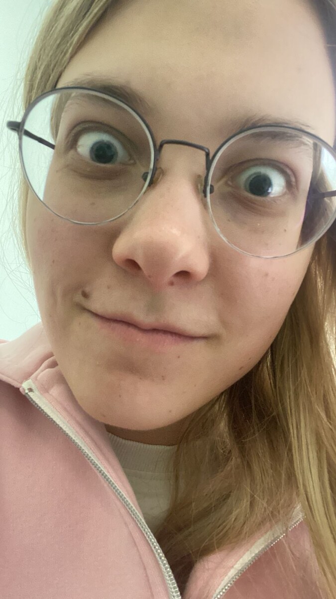 Не постесняюсь и выложу, как выглядят мои глаза после капель