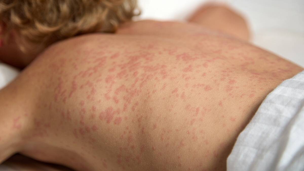    Фото: Shutterstock