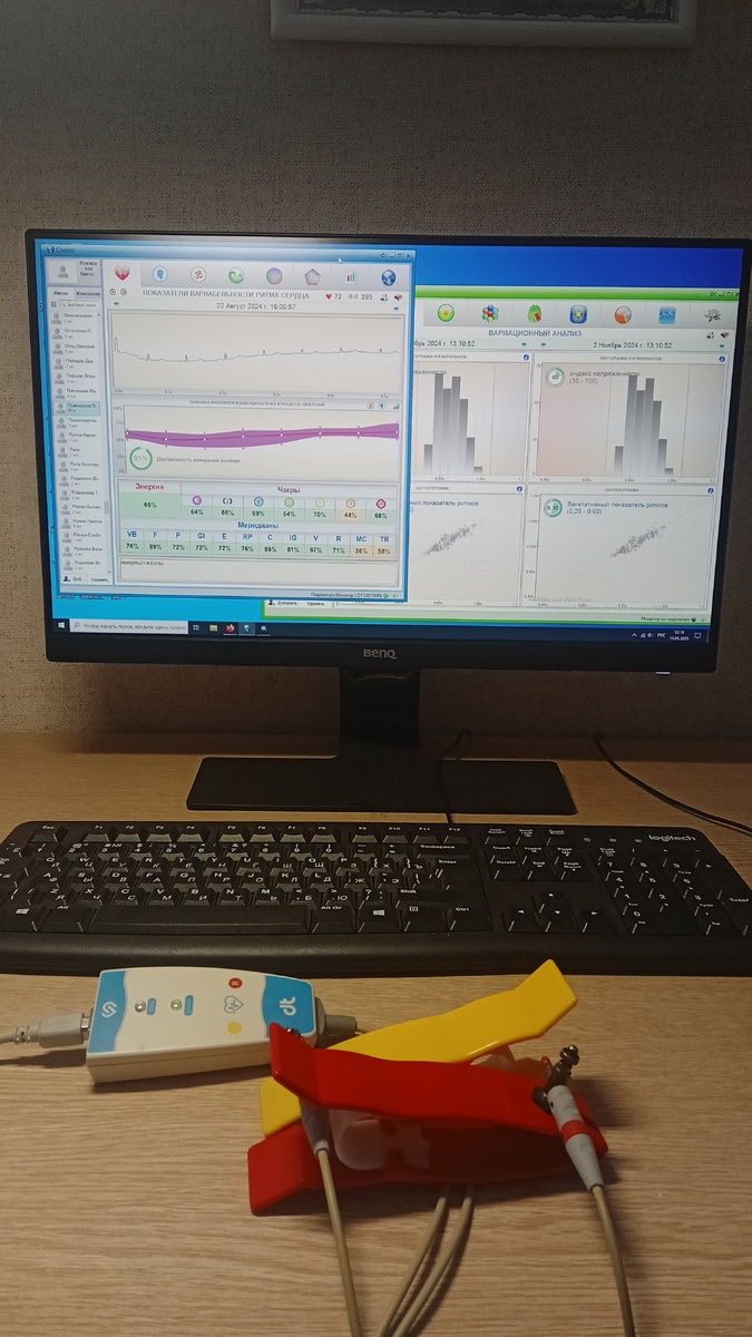 Лотос-Оникс - фото автора