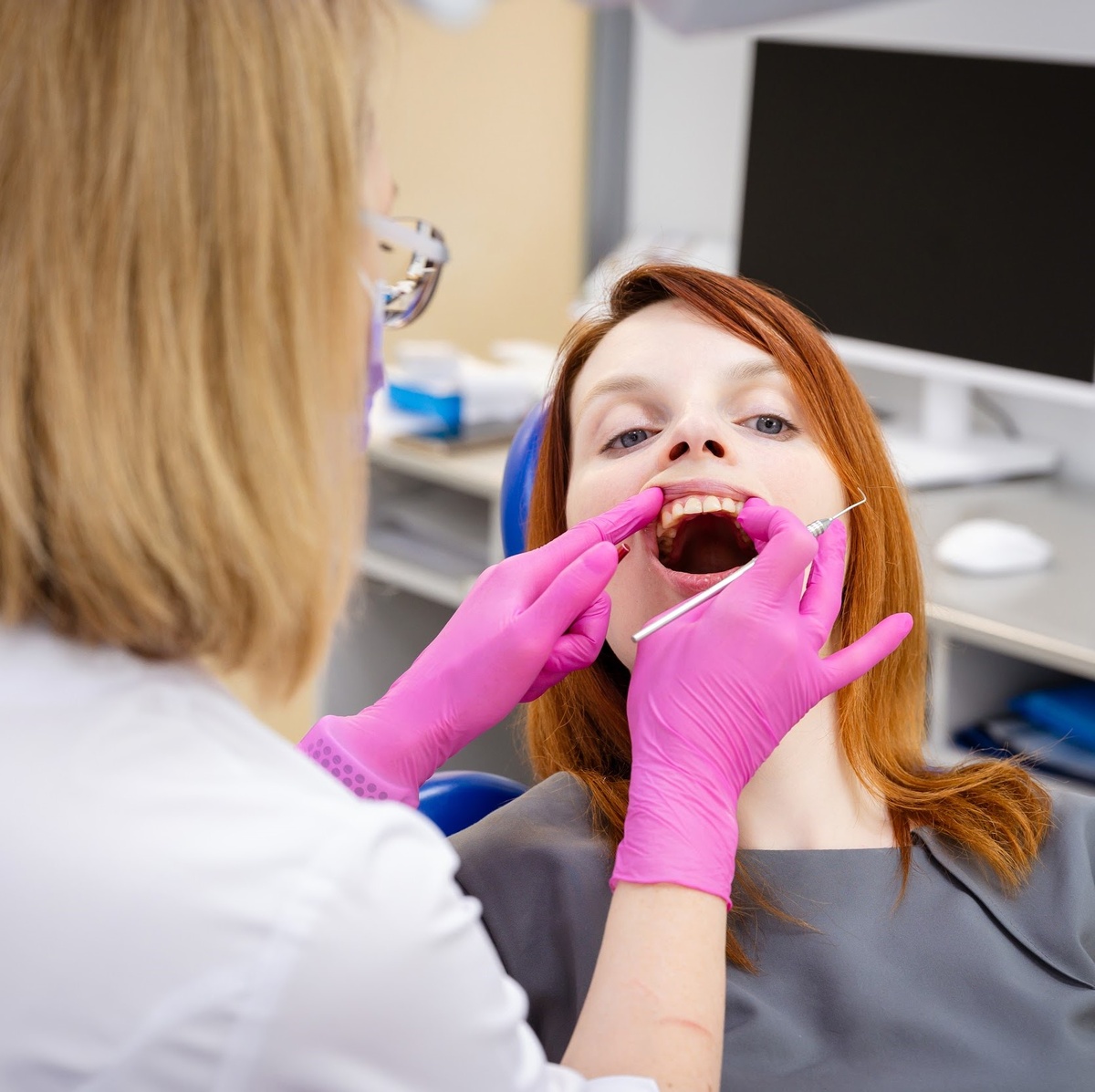 Глубокий кариес