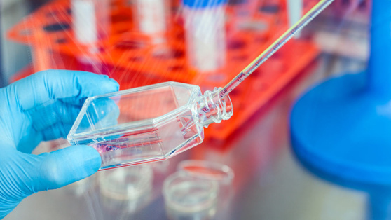    Долгоживущие культуры клеток помогут повысить производство российских лекарств Андрей Бурков