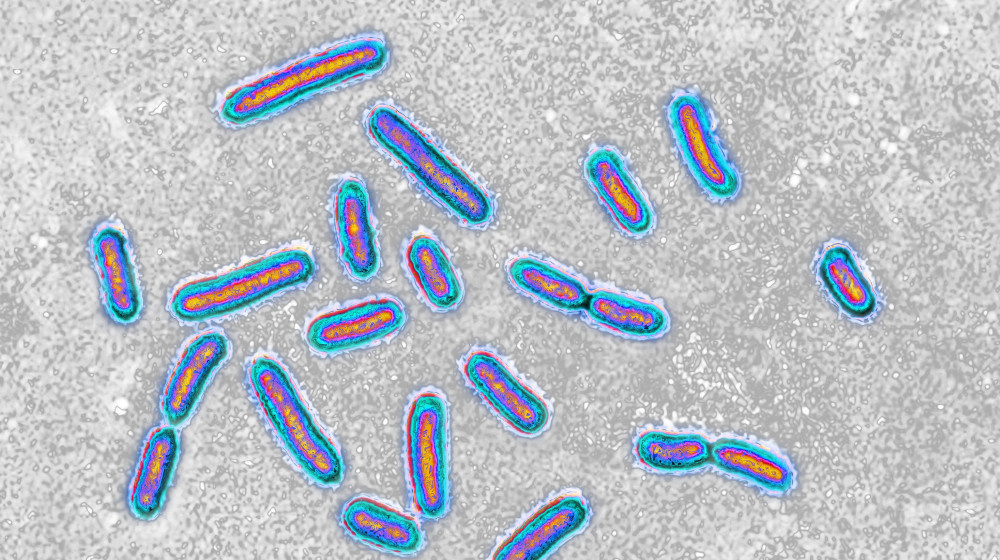    Больничная супербактерия питается медицинским пластиком