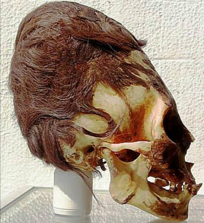 Череп из Паракаса. Аномальный объем и вес ставят под сомнение теорию искусственной деформации.