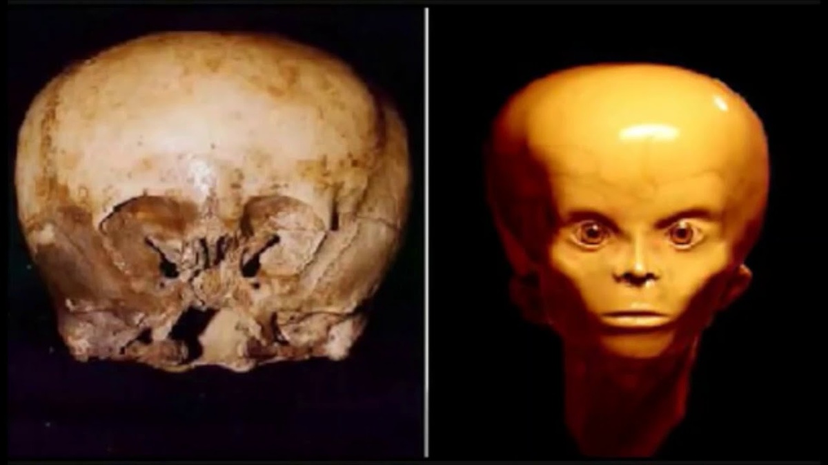 Череп "Звездного ребенка". ДНК-анализ указывает на возможное внеземное происхождение по отцовской линии.