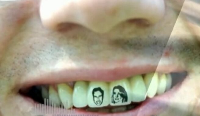   Татуировки на зубах. Фото: кадр видео